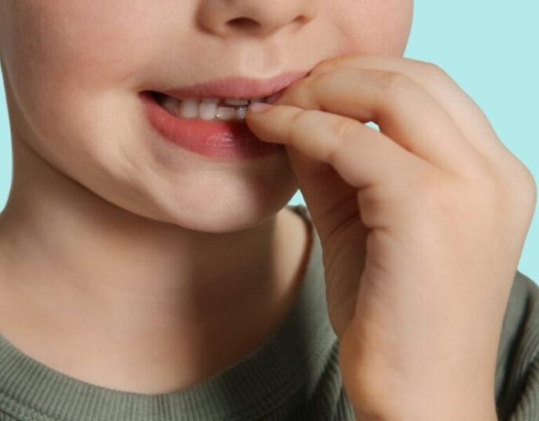 নখ কামড়ানোর কারণে নানা রোগে ভুগতে পারে শিশু, করণীয় কী?